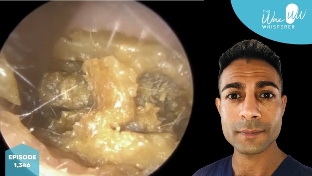 The Best Audiologist Otologist for Hearing Aid Users in Botley